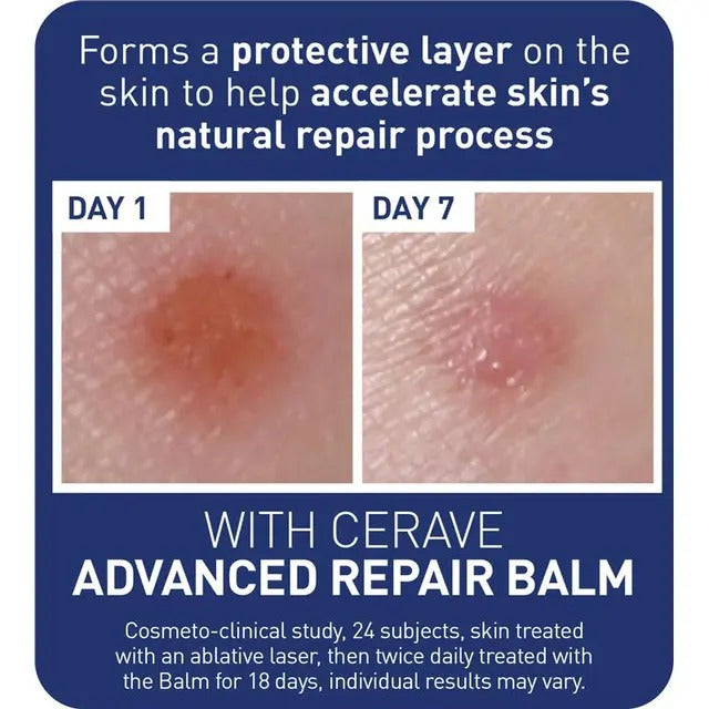 CeraVe Advanced Repair Balm 50ml for dry and rough skin hydration