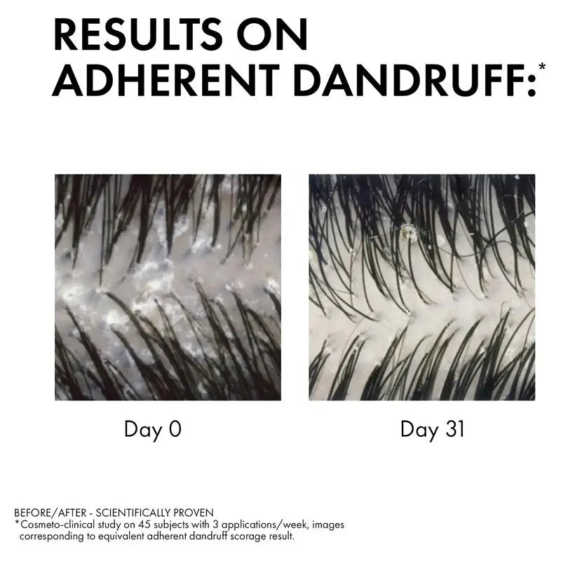 Dercos Anti-Dandruff DS Shampoo for Dry Hair 200ml for flake-free, nourished, and healthy scalp