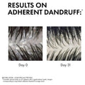 Dercos Anti-Dandruff DS Shampoo 200ml for normal to oily hair, reducing flakes and soothing scalp